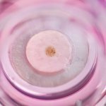 Bioprinted skin with dark spot - after maturation (Photo: LabSkin Creations)